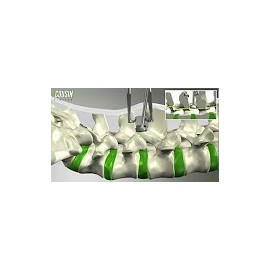 IntraSPINE dispositivo para o espaço interspinoso