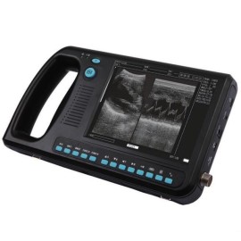 ultra-som scanners portáteis