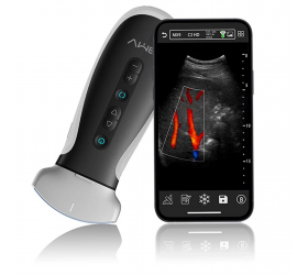Ultrassom Doppler Portátil de cor de bolso sem fio MX9
