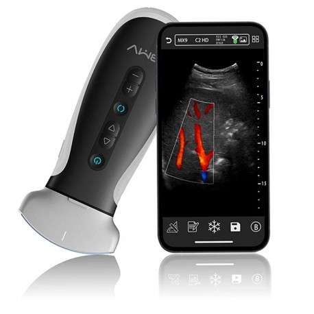 Ultrassom Doppler Portátil de cor de bolso sem fio MX9